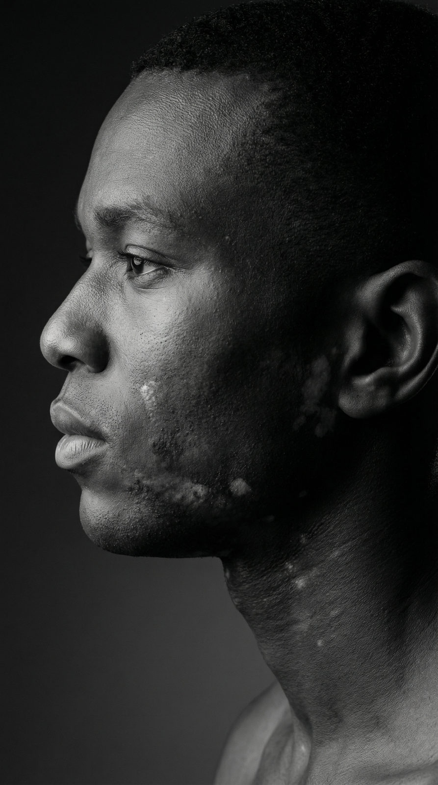 Vitiligo Side Profile Studio Portrait