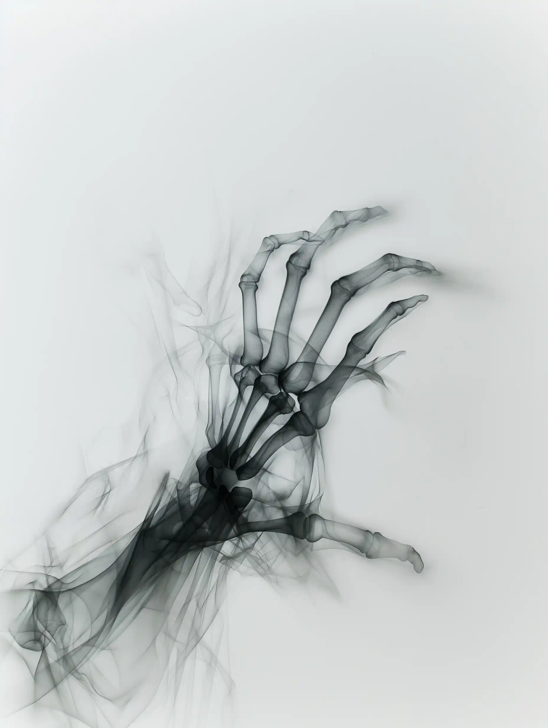 Frosted Glass X-Ray Photo
