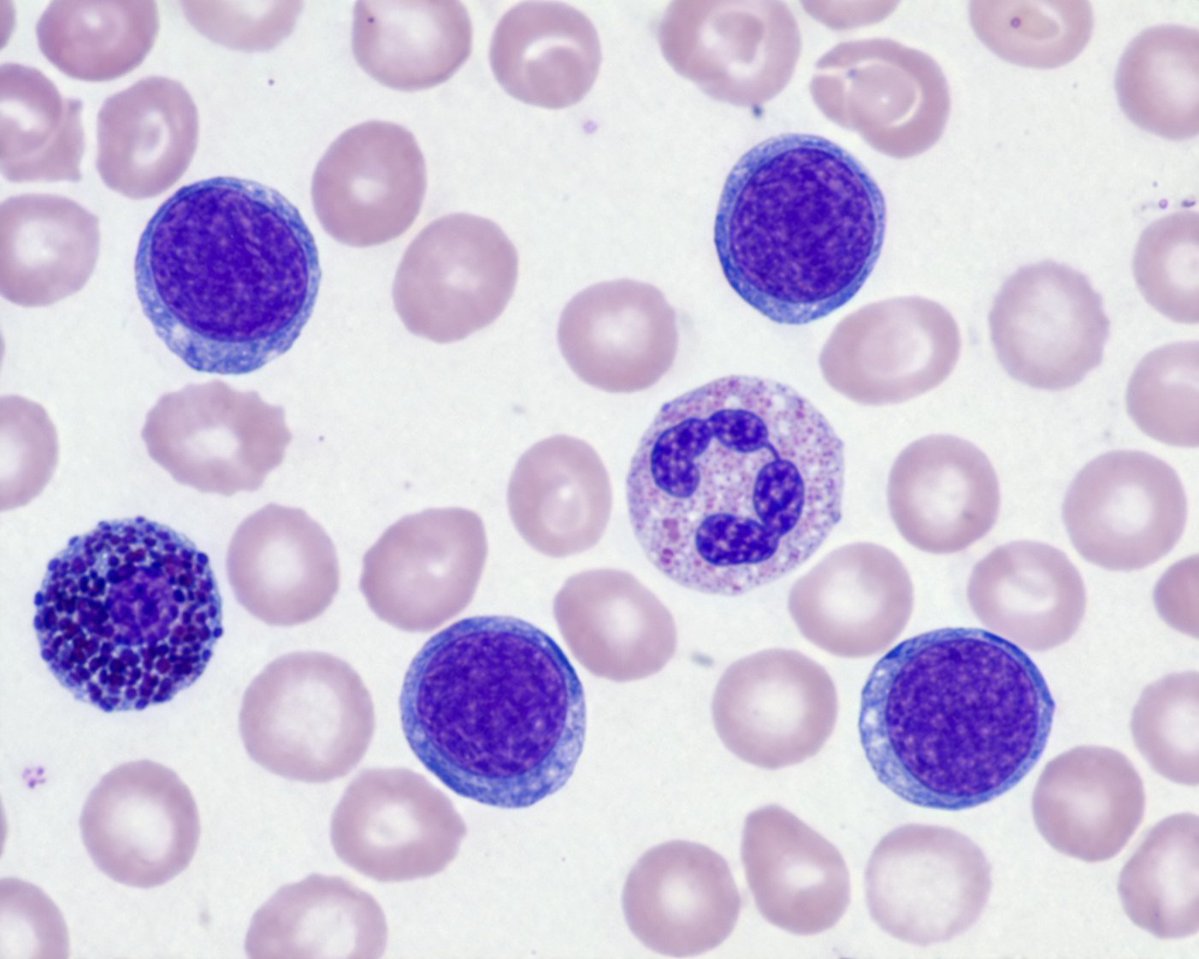 Giemsa Stained Blood Cells Microscopy