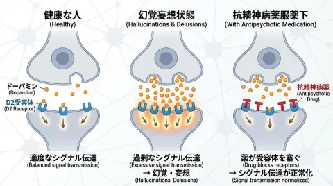 Dopamine D2 Receptors and Schizophrenia