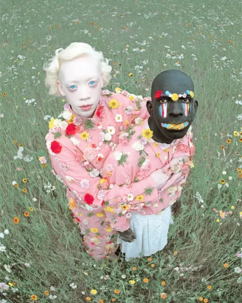 A surreal photograph of two unusual people: an albino woman with blue eyes and blonde hair