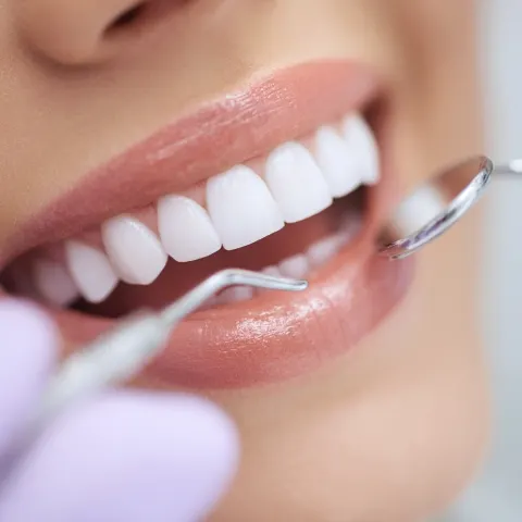 Extreme close-up of professional dental cleaning, patient with slightly open mouth